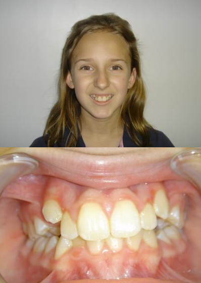 Smile Gallery Lake Charles Orthodontics Lake Charles Moss Bluff Iowa LA