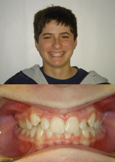 Smile Gallery Lake Charles Orthodontics Lake Charles Moss Bluff Iowa LA